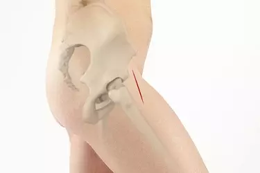 Best Partial Hip Replacement Surgeon In India , Cost Of Partial Hip Replacement In India | Best Hospital for Partial Hip Replacement in India, dr anubhav jain best orthopaedic surgoen in india, dr subhash jangid best hip replacement surgeon in india